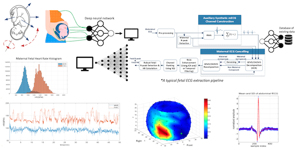 Noninvasive fetal electrocardiography