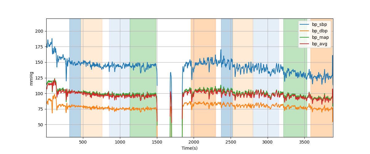 Subject P015 blood pressure data processing summary - Overlay