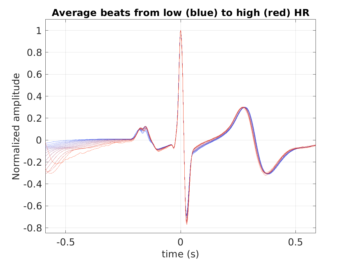 P015_ecg_avg_beats_hr_binned