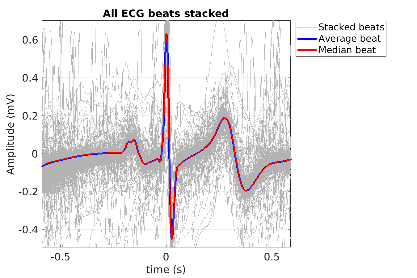 P015_ecg_beats_stacked