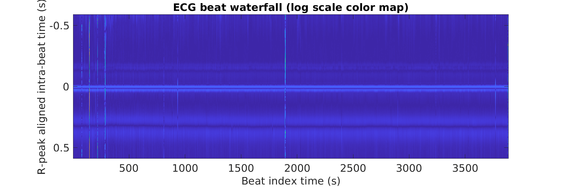 P015_ecg_beats_waterfall_logscale