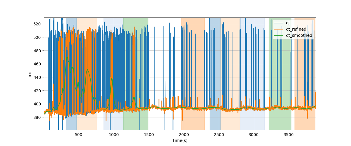 QT intervals - Overlay