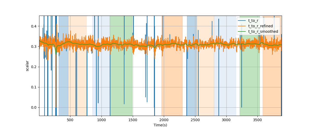 T/R wave ratio - Overlay