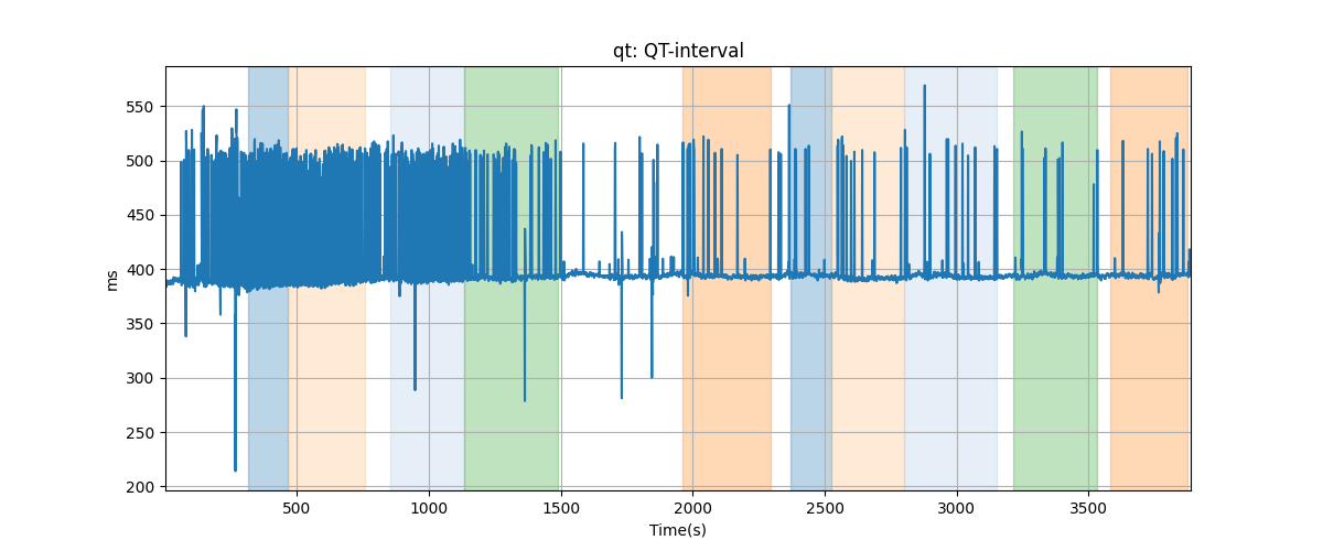 qt: QT-interval