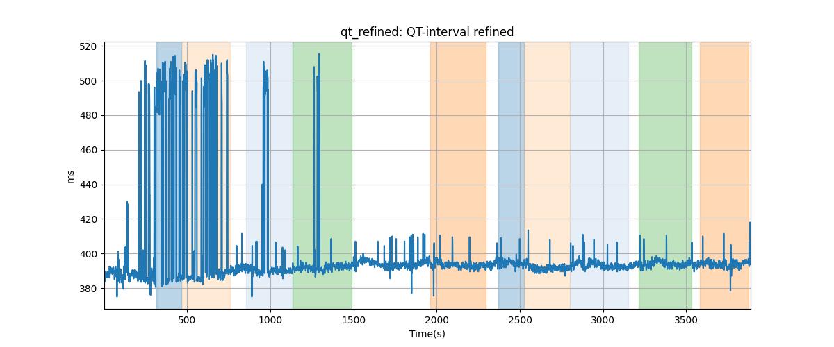 qt_refined: QT-interval refined