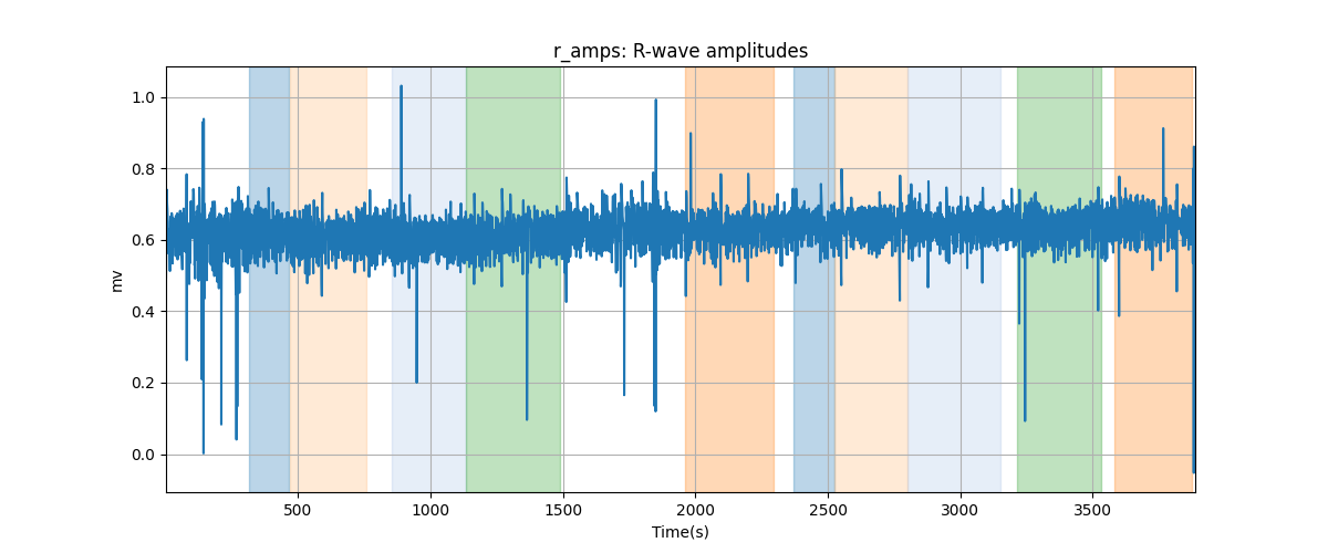 r_amps: R-wave amplitudes