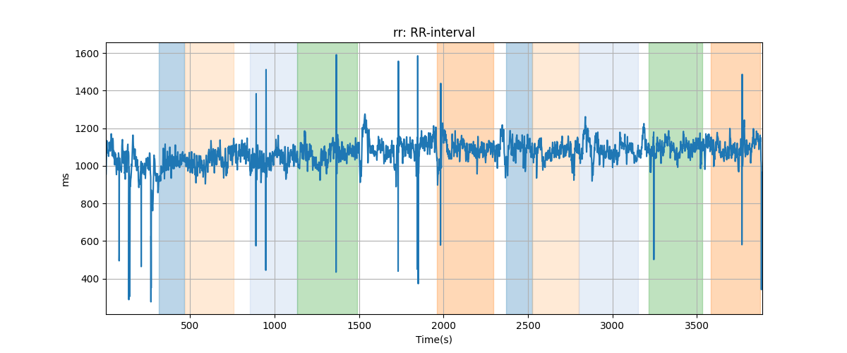 rr: RR-interval