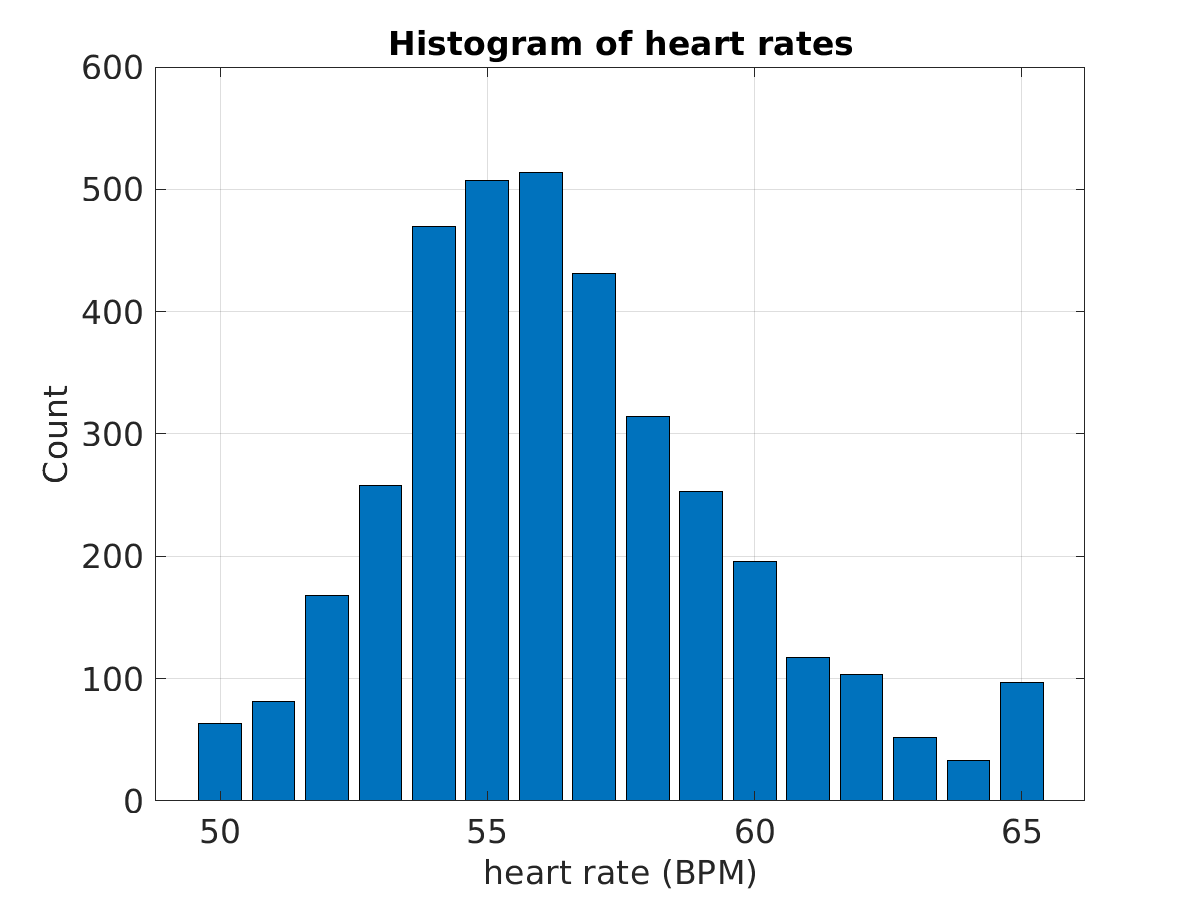 P015_ecg_hr_hist