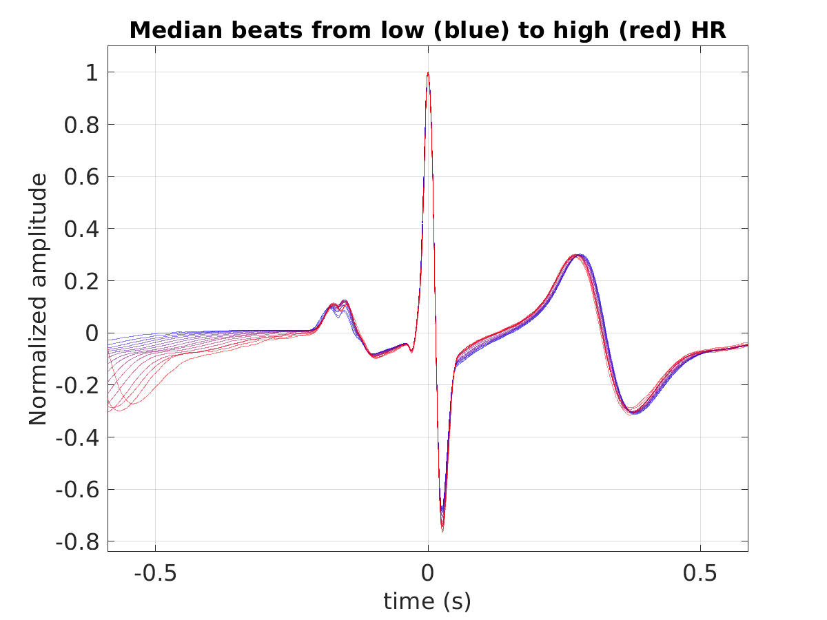 P015_ecg_med_beats_hr_binned