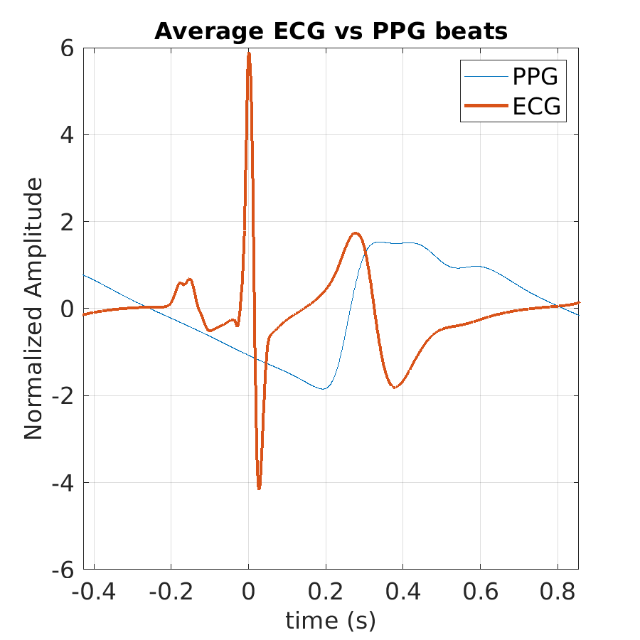 P015_ppg_avg_ecg_ppg