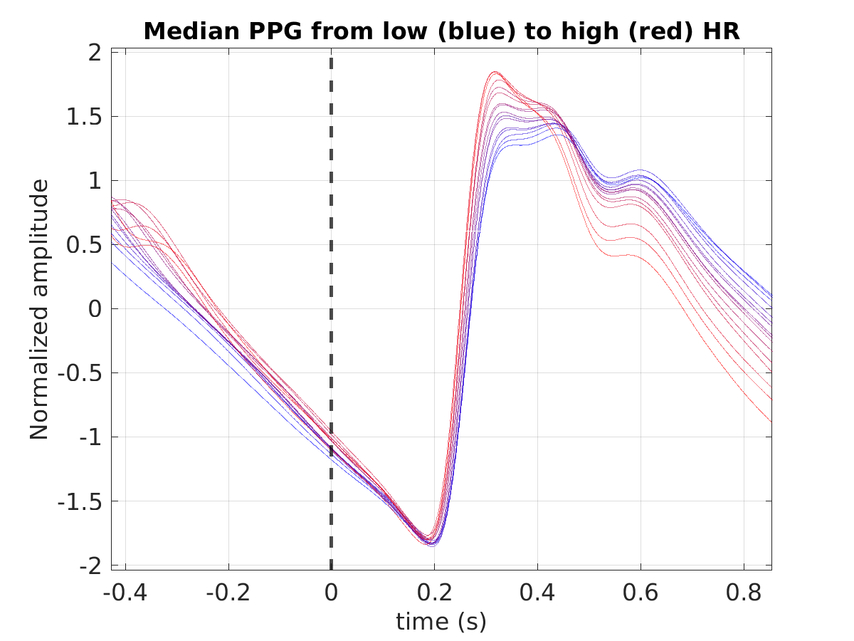 P015_ppg_med_ppg_hr_binned_norm