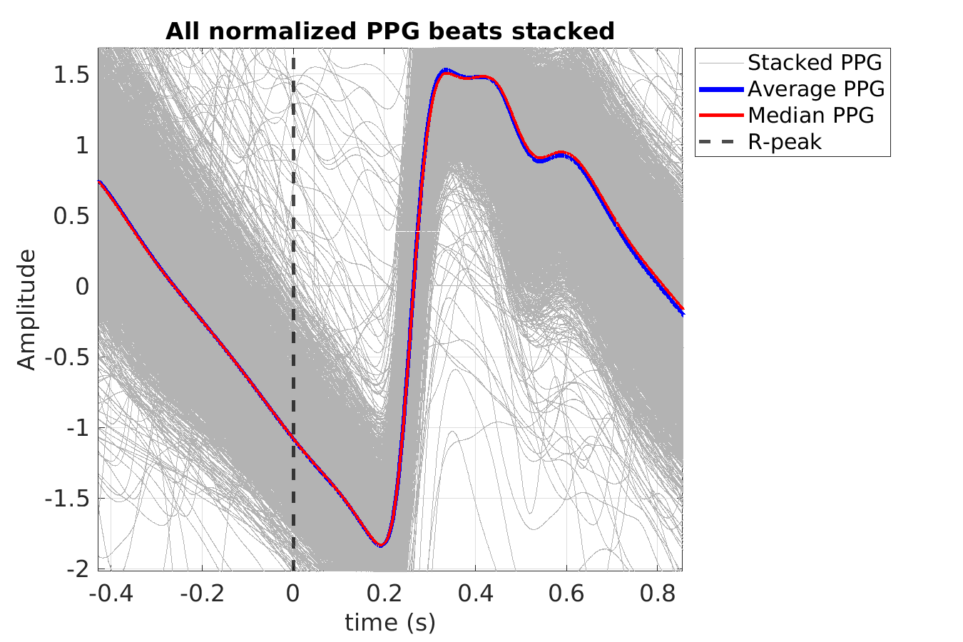 P015_ppg_ppg_stacked_norm