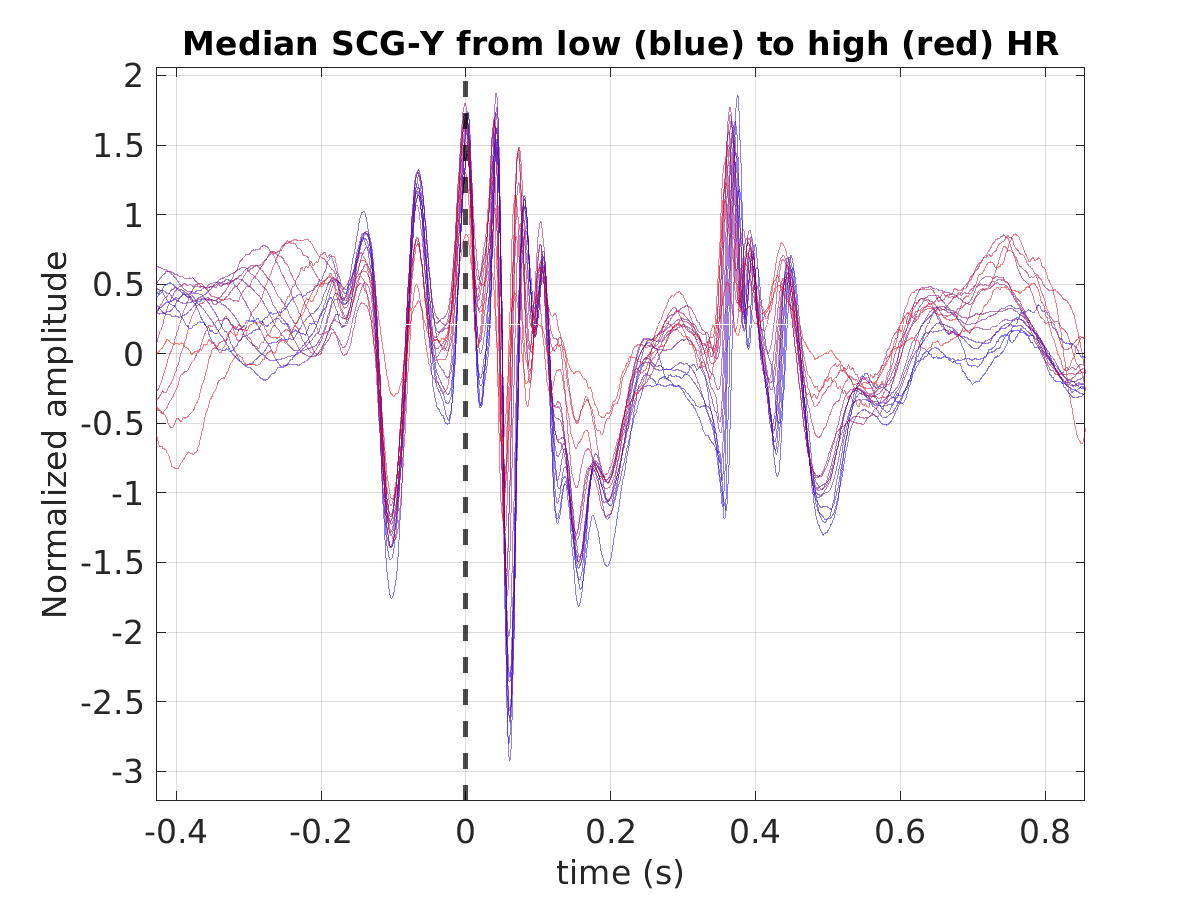 P015_scg_med_scgy_hr_binned_norm