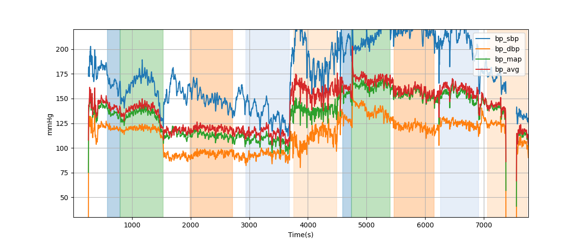 Subject S003 blood pressure data processing summary - Overlay