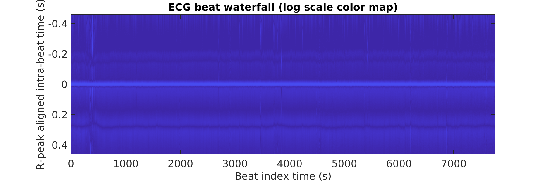 S003_ecg_beats_waterfall_logscale