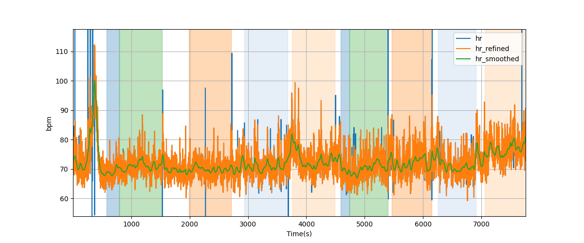 Heart rate - Overlay