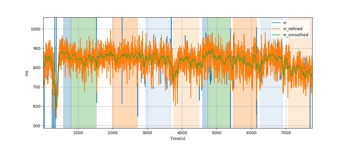 RR intervals - Overlay