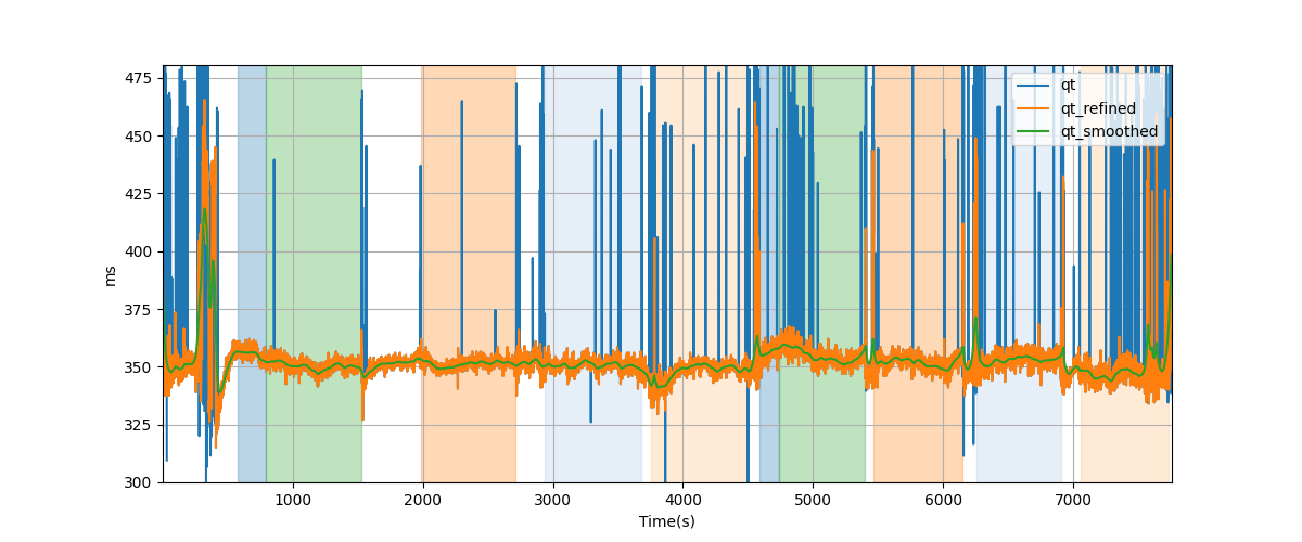 QT intervals - Overlay