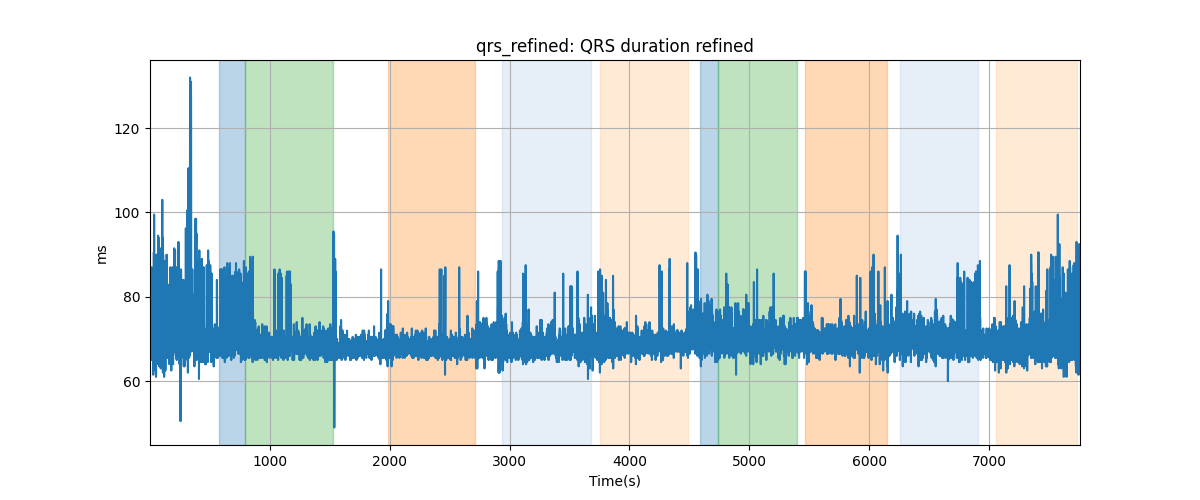 qrs_refined: QRS duration refined