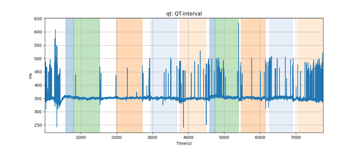 qt: QT-interval