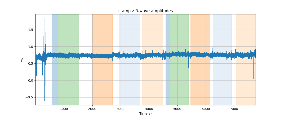 r_amps: R-wave amplitudes