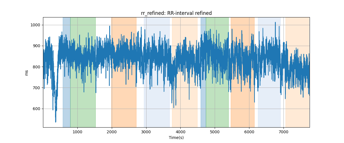 rr_refined: RR-interval refined