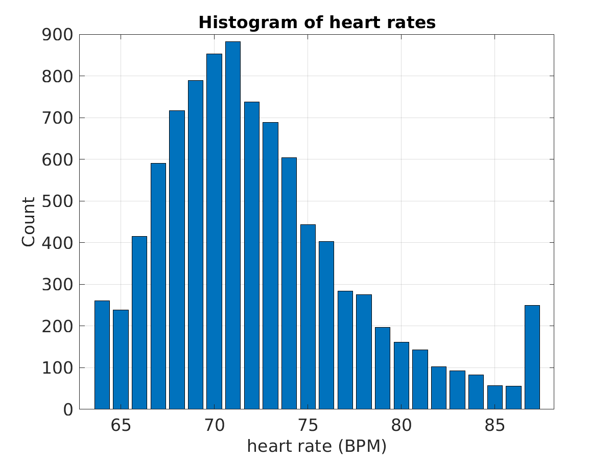 S003_ecg_hr_hist