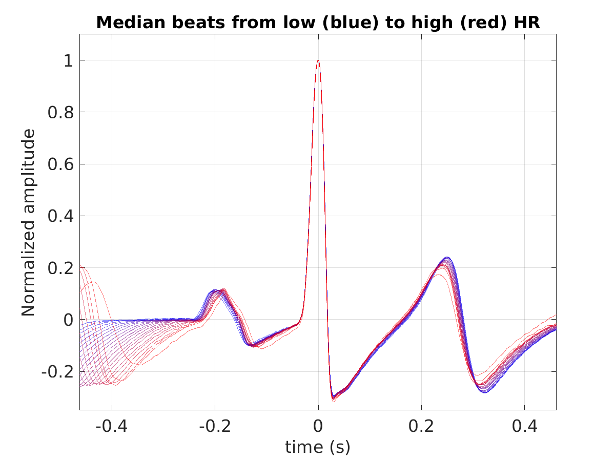 S003_ecg_med_beats_hr_binned