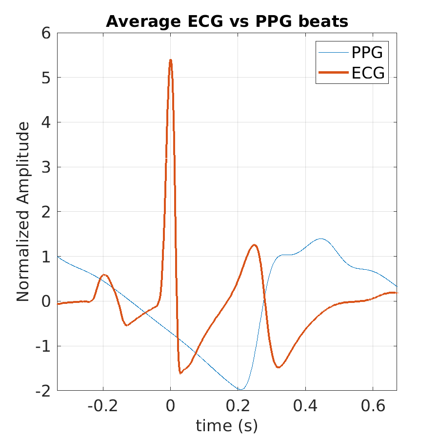 S003_ppg_avg_ecg_ppg