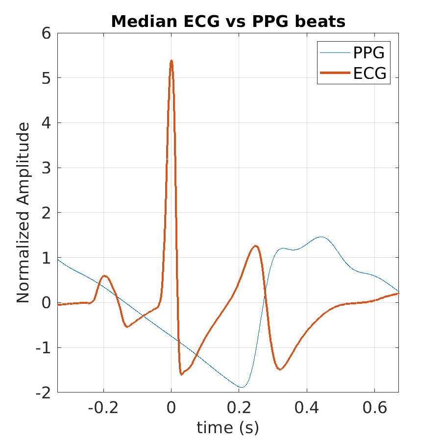 S003_ppg_med_ecg_ppg