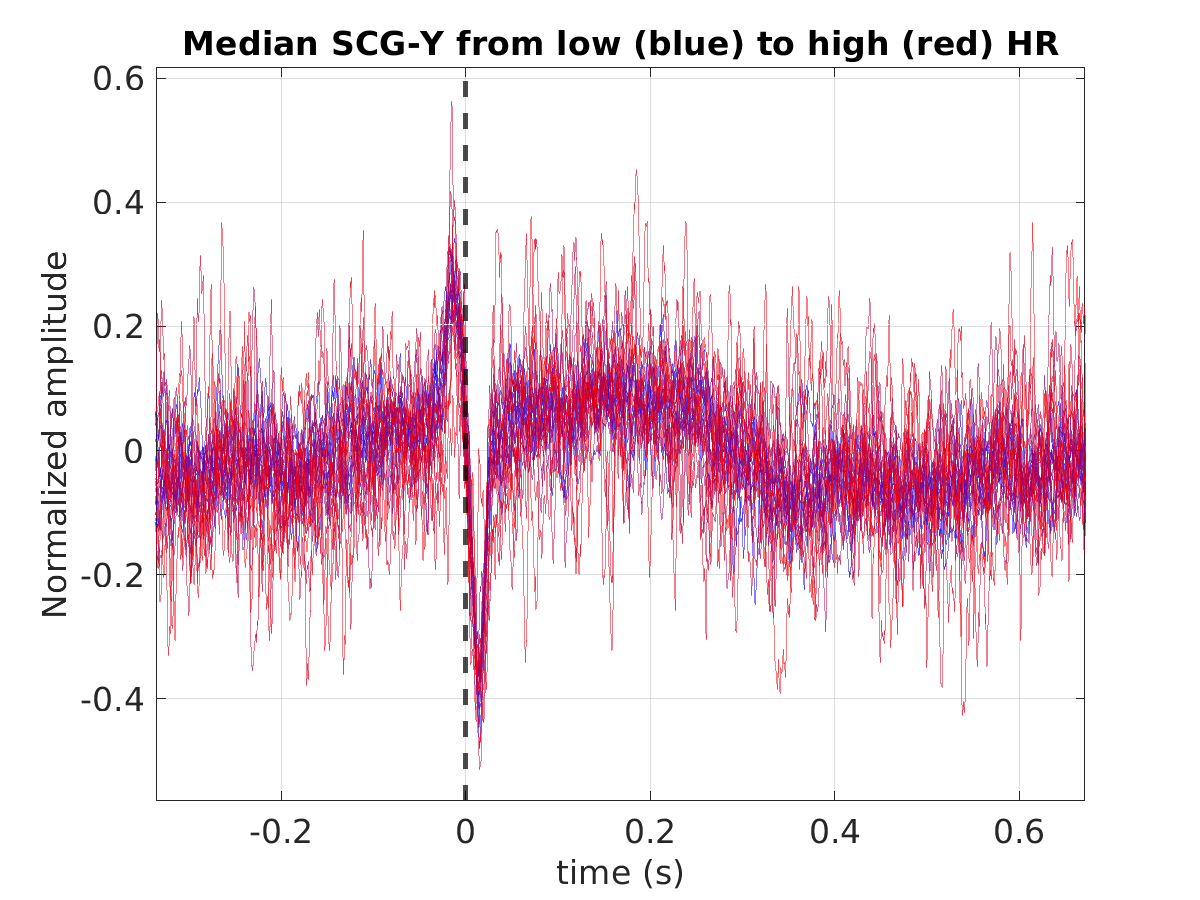 S003_scg_med_scgy_hr_binned_norm