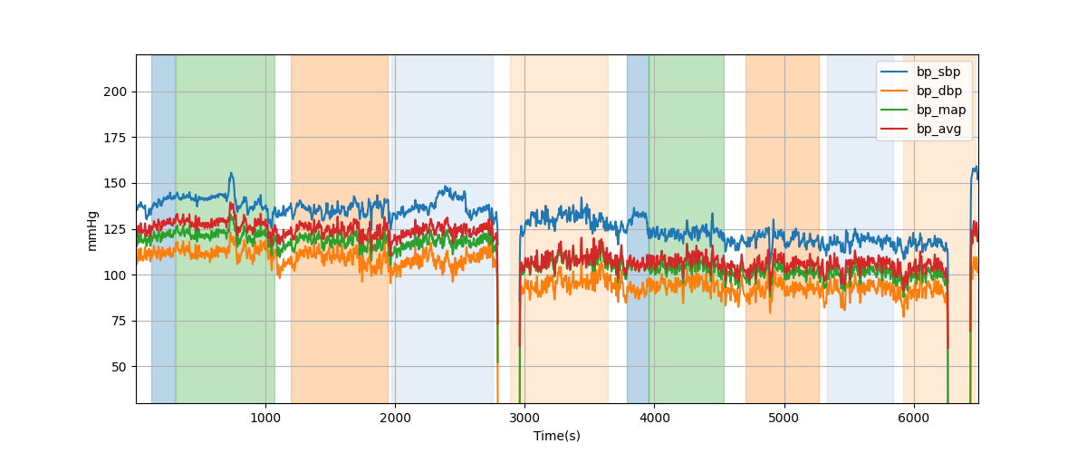 Subject S008 blood pressure data processing summary - Overlay