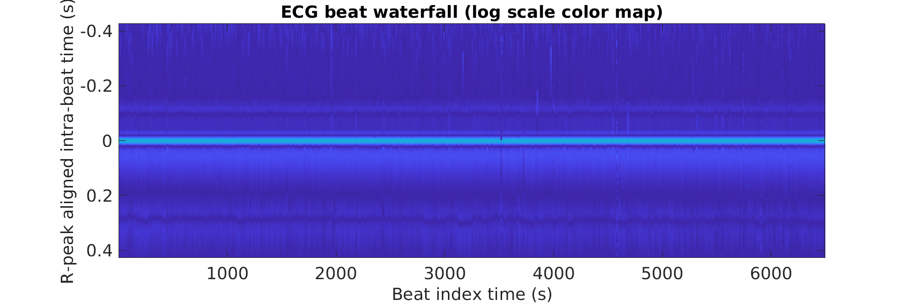 S008_ecg_beats_waterfall_logscale