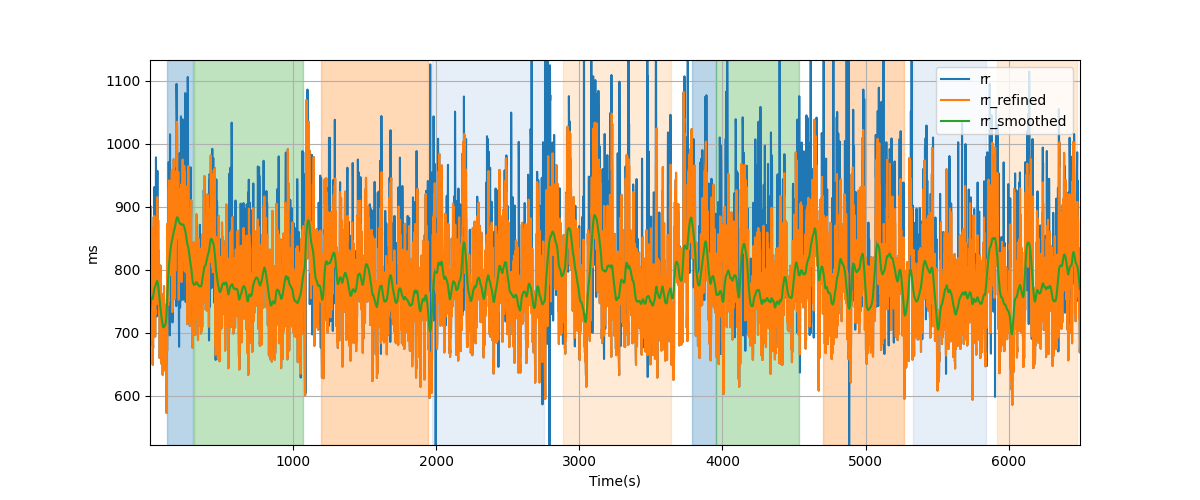 RR intervals - Overlay