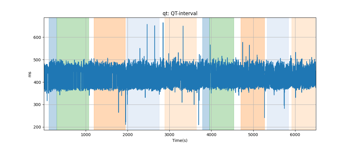 qt: QT-interval