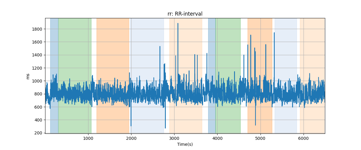 rr: RR-interval