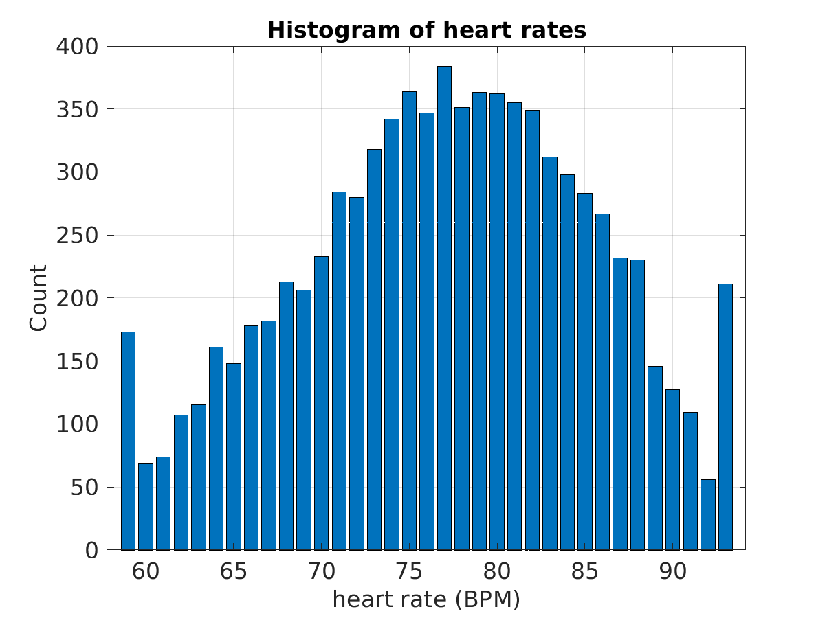 S008_ecg_hr_hist