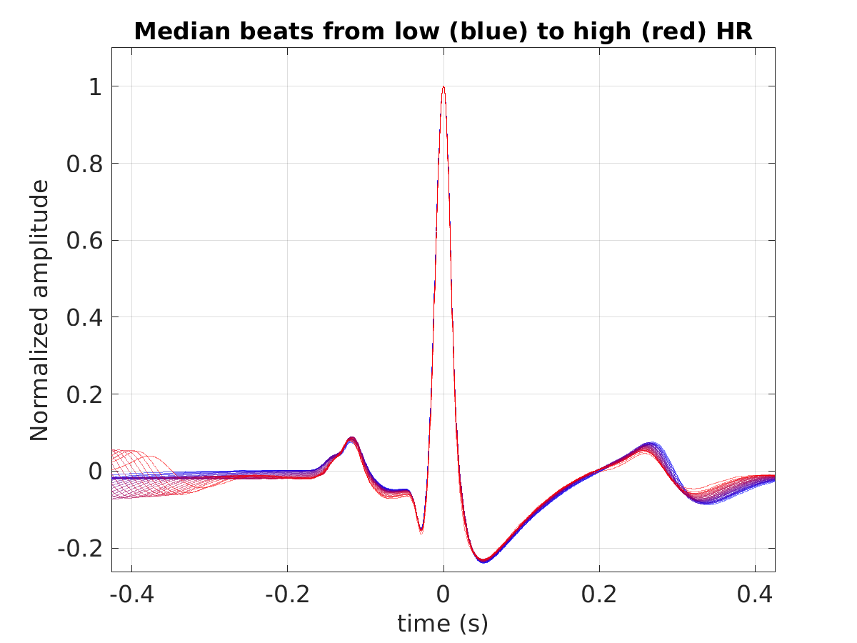 S008_ecg_med_beats_hr_binned