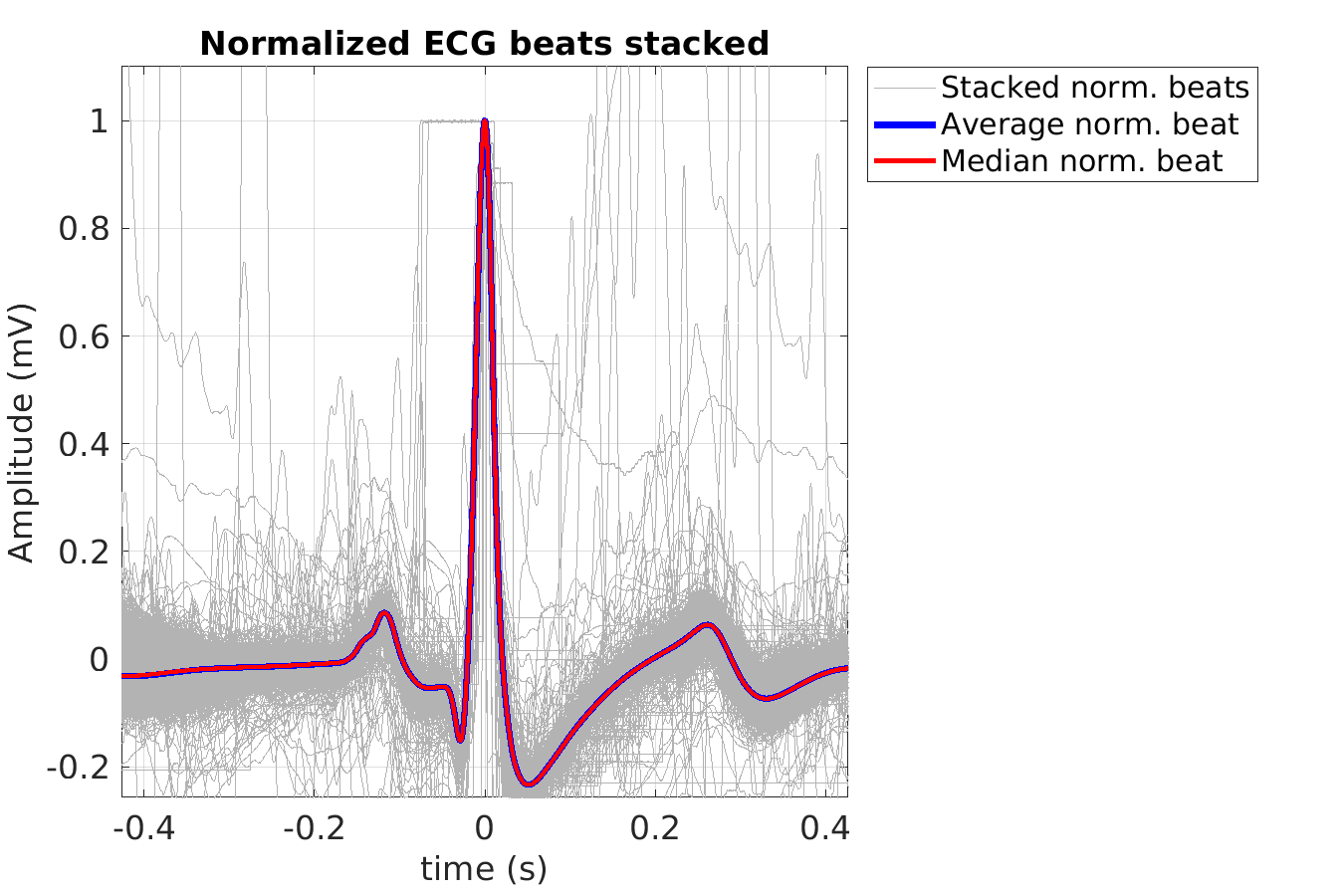 S008_ecg_norm_beats_stacked