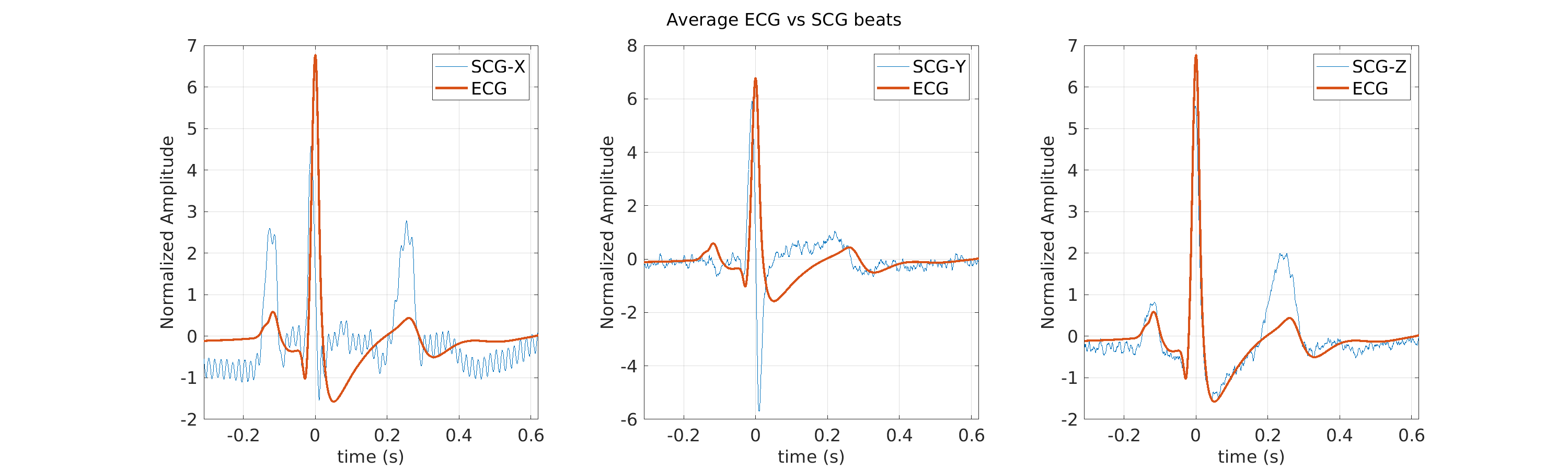 S008_scg_avg_ecg_scg