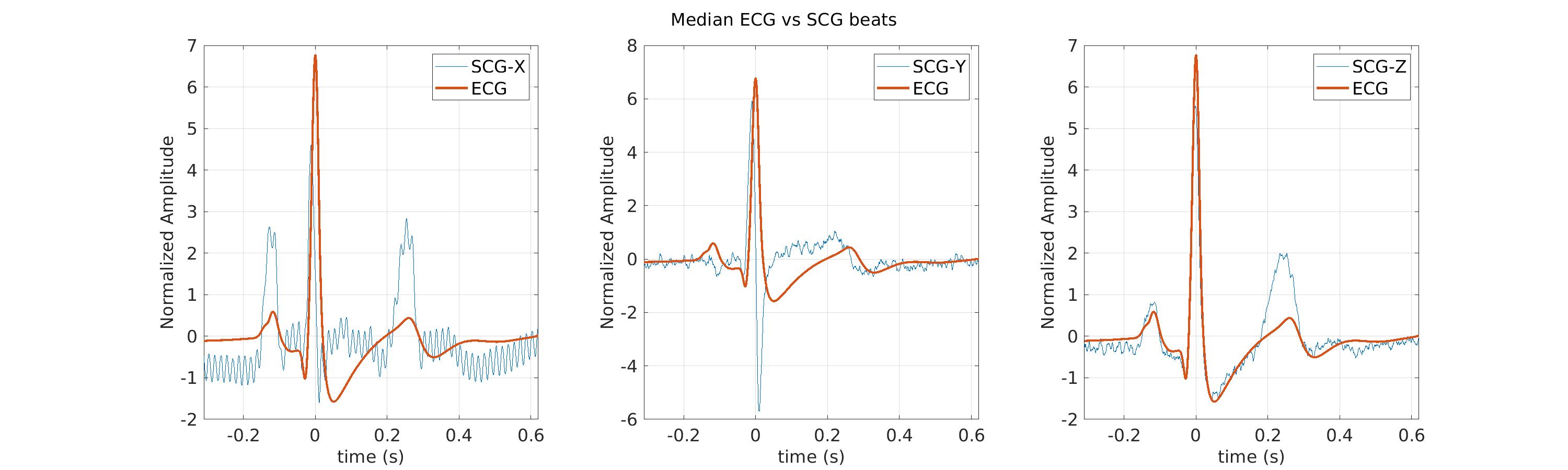 S008_scg_med_ecg_scg