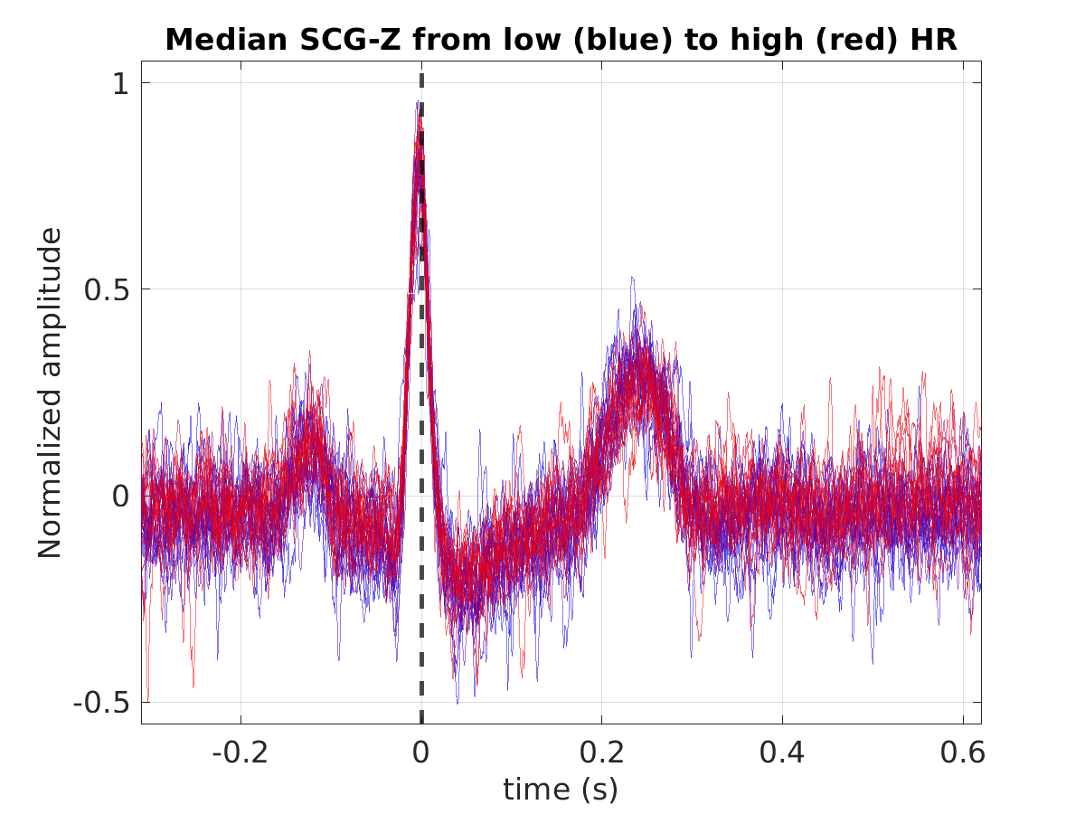 S008_scg_med_scgz_hr_binned_norm