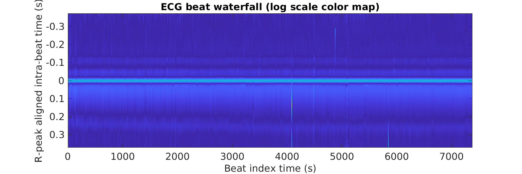 S010_ecg_beats_waterfall_logscale