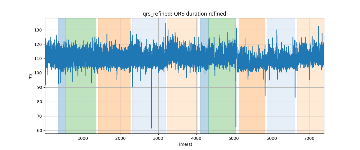 qrs_refined: QRS duration refined