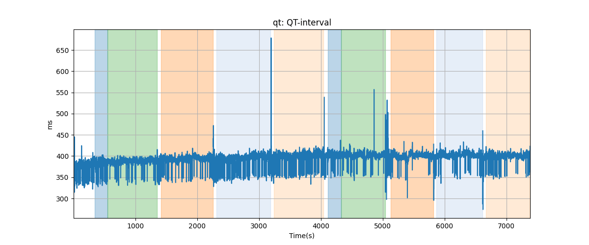 qt: QT-interval