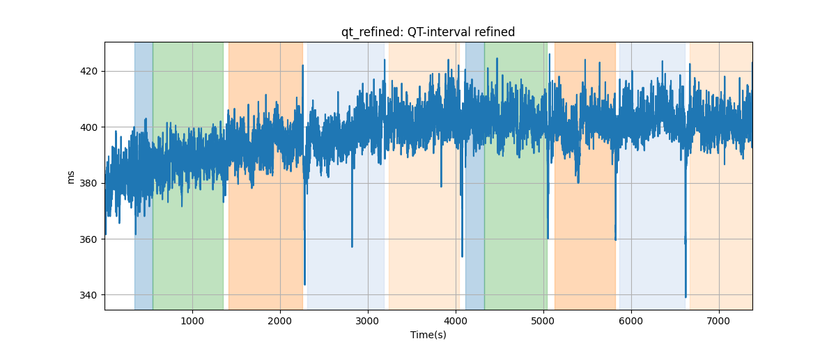 qt_refined: QT-interval refined