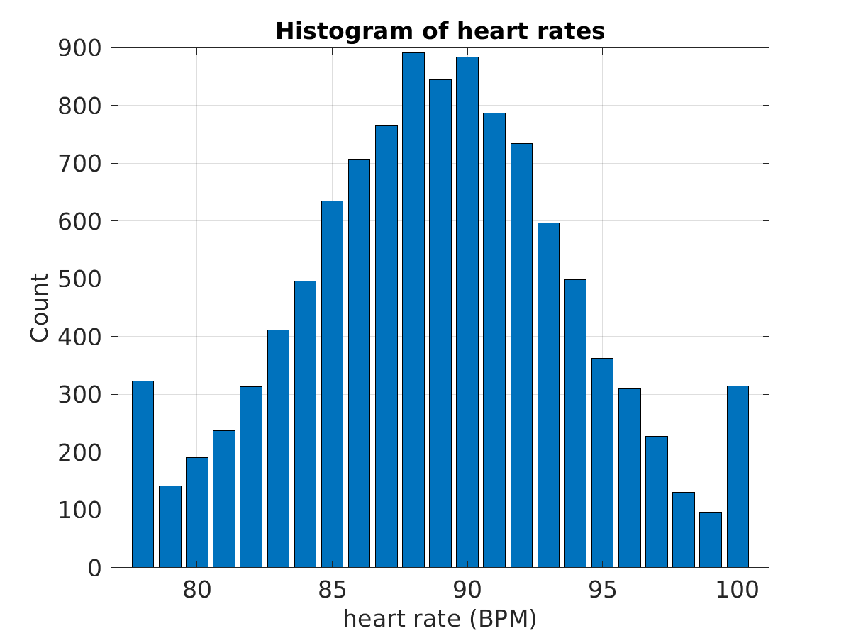 S010_ecg_hr_hist