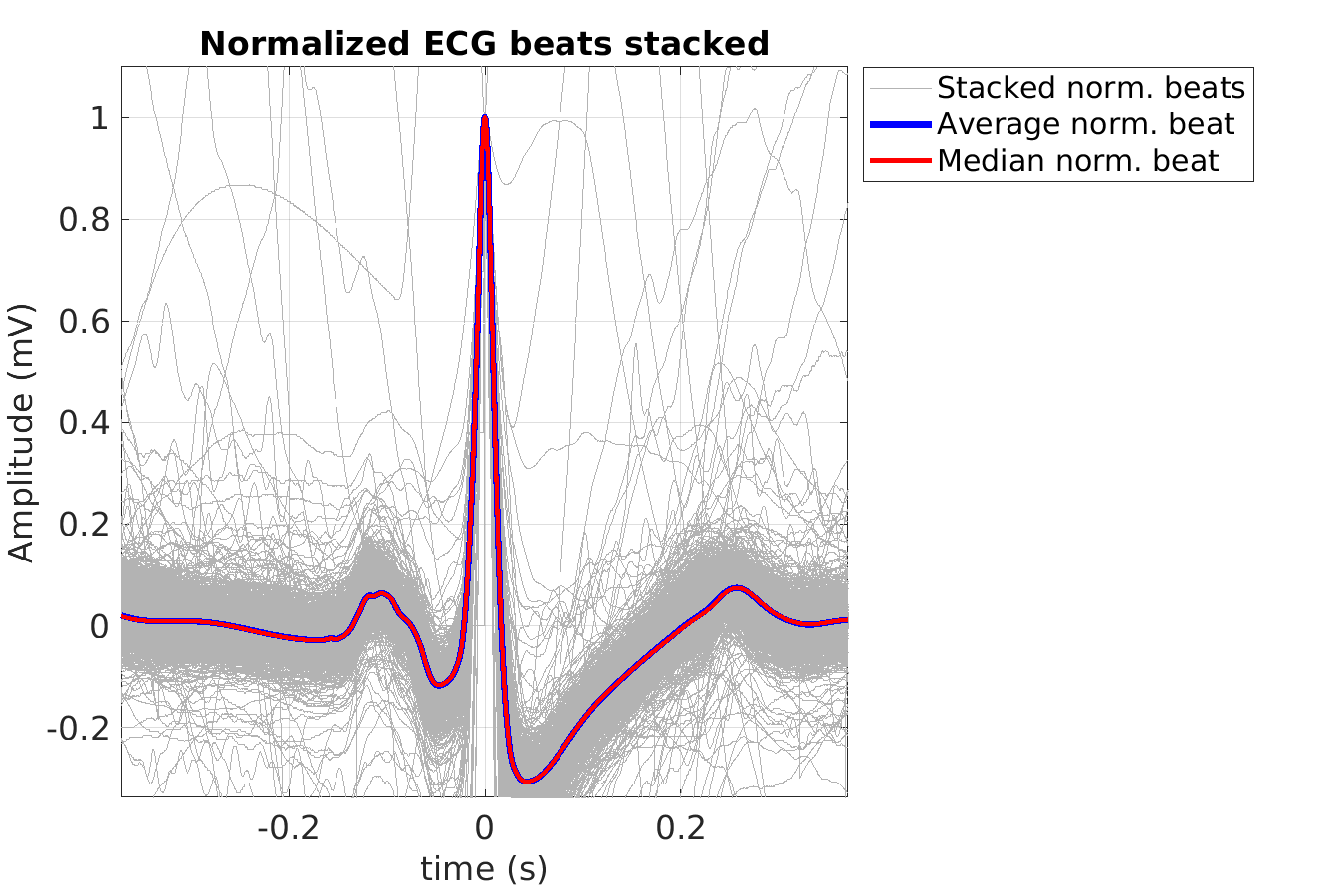 S010_ecg_norm_beats_stacked