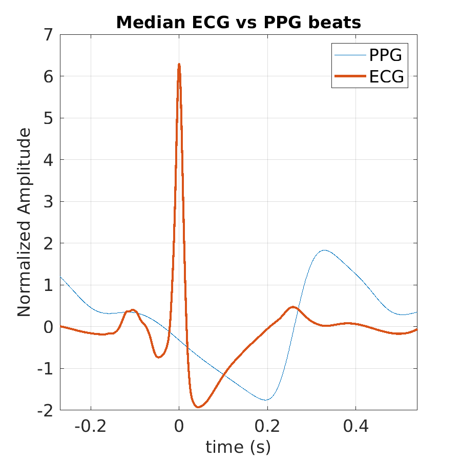 S010_ppg_med_ecg_ppg