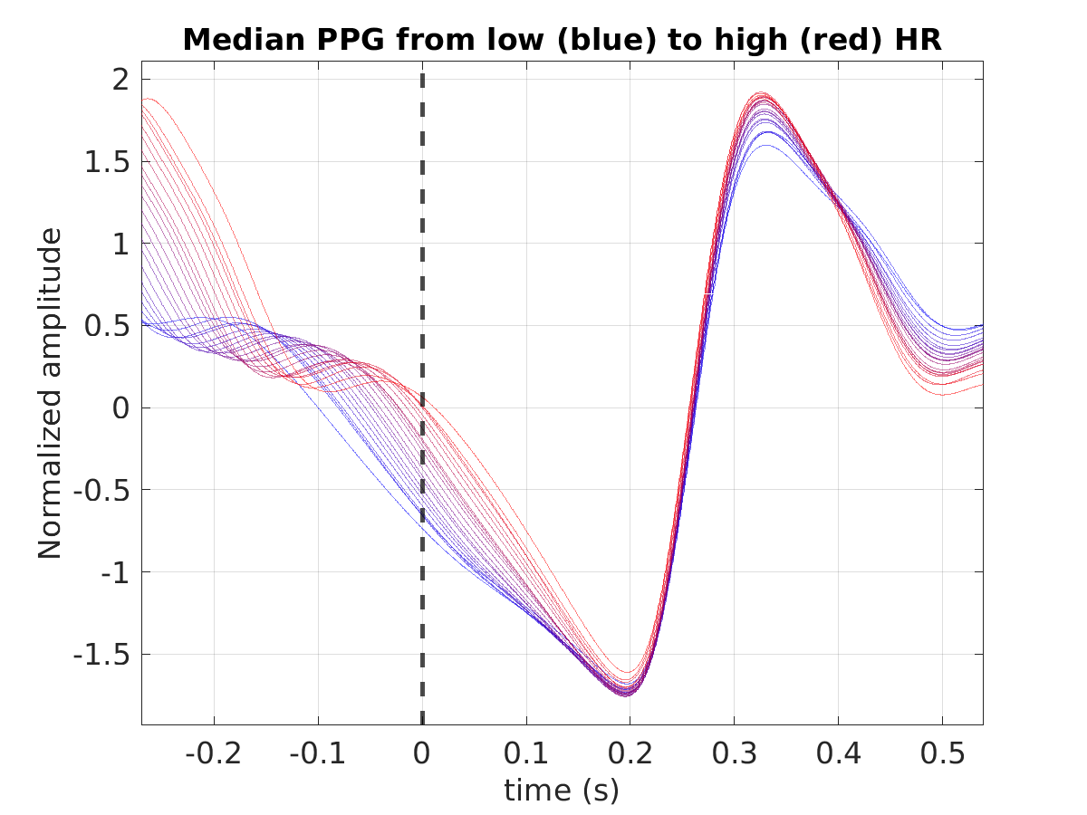 S010_ppg_med_ppg_hr_binned_norm